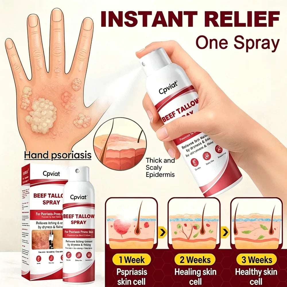 Beef Tallow Itch Relief Spray